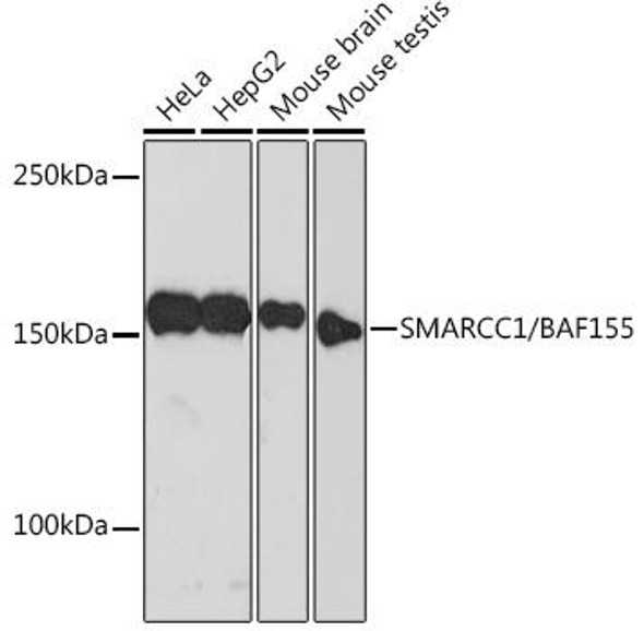 Anti-SMARCC1/BAF155 Antibody (CAB4275)
