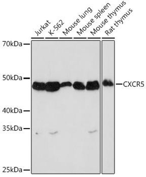 Anti-CXCR5 Antibody (CAB8950)