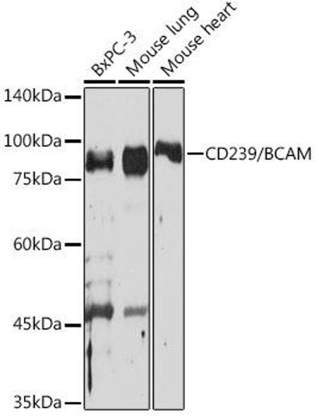 Anti-CD239/BCAM Antibody (CAB19724)