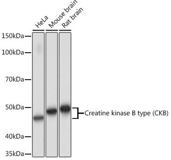 Anti-Creatine kinase B type (CKB) Antibody (CAB4907)