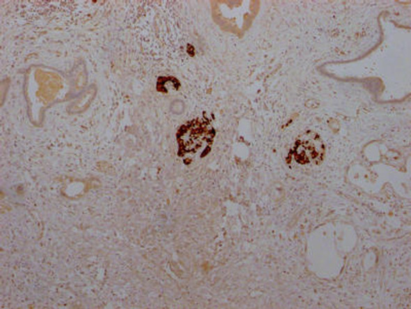 Anti-INS Antibody (RACO0216)