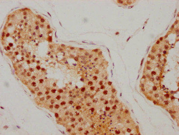 Anti-ATM Antibody (RACO0152)