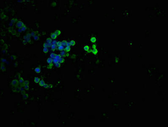 Anti-Phospho-TP53 (T55) Antibody (RACO0053)