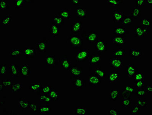 Anti-Phospho-TP53 (S33) Antibody (RACO0126)