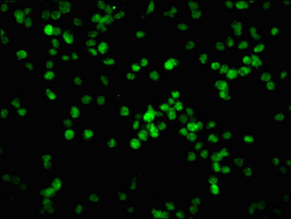 Anti-Phospho-RB1 (S780) Antibody (RACO0129)