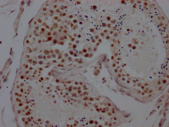 Anti-KDM1A Antibody (RACO0217)