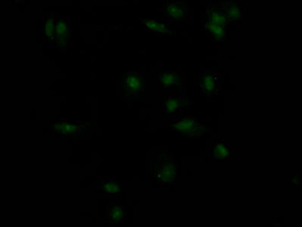 Anti-INSR Antibody (RACO0476)