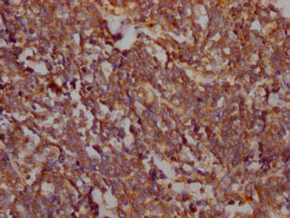 Anti-PTK2 Antibody (RACO0548)