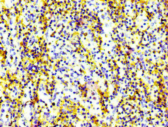 Anti-CD97 Antibody (RACO0048)