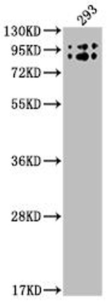 Anti-BCHE Antibody (RACO0375)