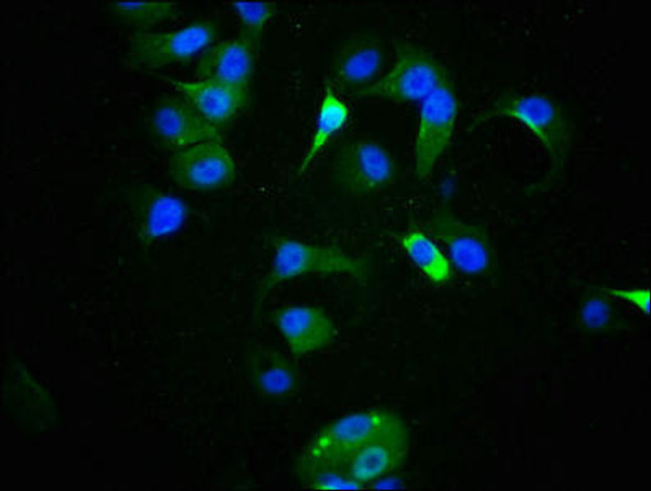 Anti-Phospho-TP53 (S9) Antibody (RACO0127)