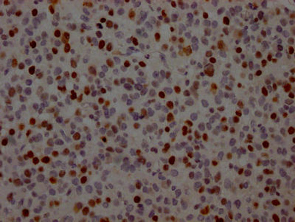 Anti-TP53 Antibody (RACO0405)