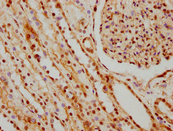 Anti-HNRNPC Antibody (RACO0191)