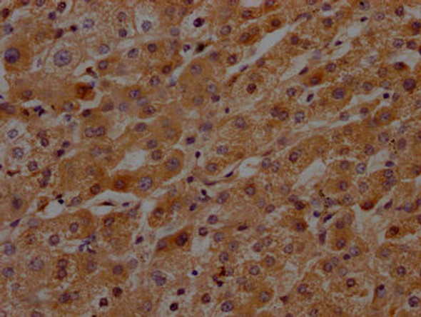 Anti-KLKB1 Antibody (RACO0360)