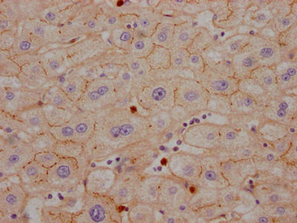 Anti-CEACAM1 Antibody (RACO0530)