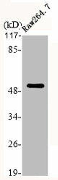 KRT7 Antibody (PACO06416)