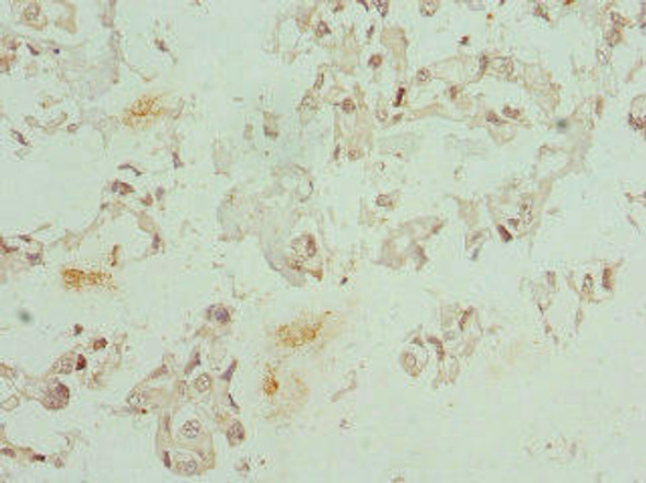 CFDP1 Antibody (PACO44233)