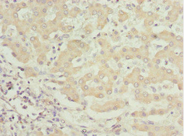 BNIP1 Antibody (PACO44612)