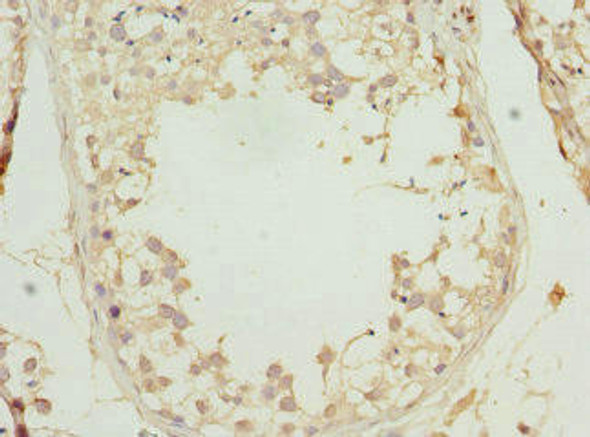 PRICKLE2 Antibody (PACO44789)
