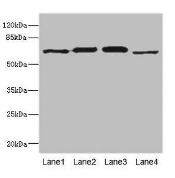 RPN2 Antibody (PACO44848)