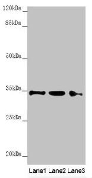 HADH Antibody (PACO44905)