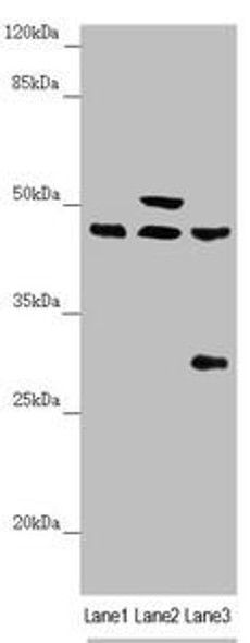 HAUS8 Antibody (PACO45103)