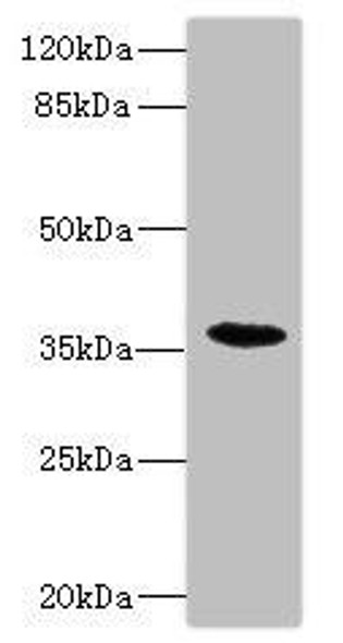 BST1 Antibody (PACO45380)