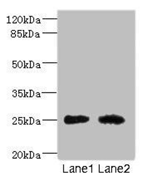 CEACAM4 Antibody (PACO45418)