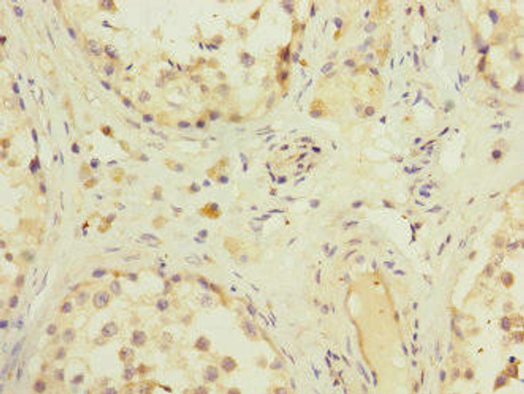 ZFPM2 Antibody (PACO45541)