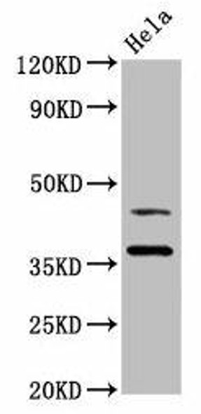 DNAJA1 Antibody (PACO45770)