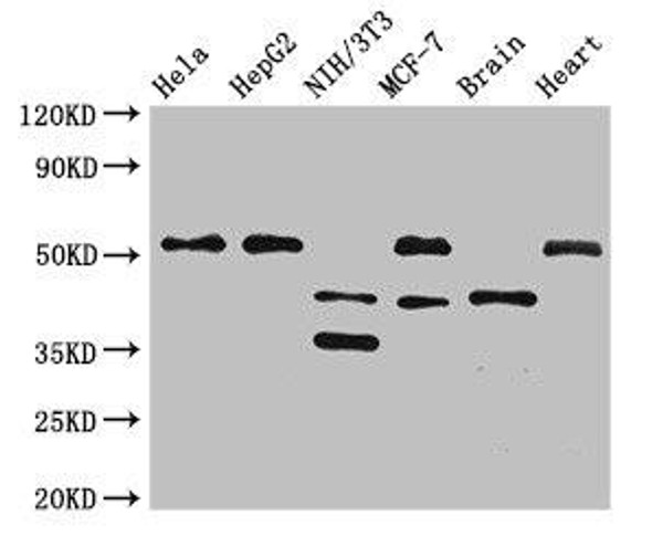 LAX1 Antibody (PACO50766)