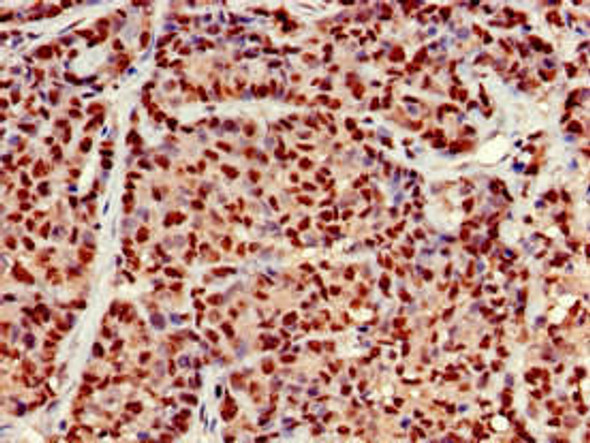 EARS2 Antibody (PACO52430)