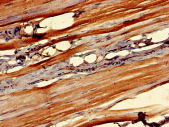 OSMR Antibody (PACO52722)