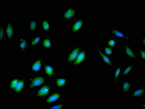 BIN3 Antibody (PACO53222)