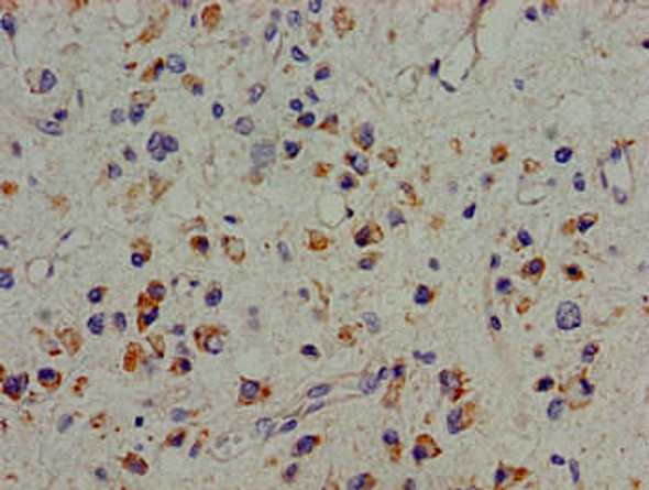 PTK2B Antibody (PACO53842)