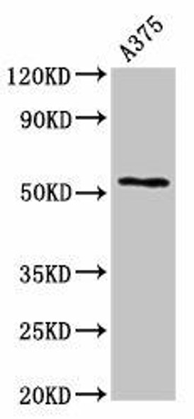 CPE Antibody (PACO57712)