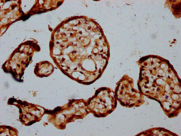 STT3B Antibody (PACO59241)