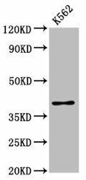 PRB1 Antibody (PACO59864)