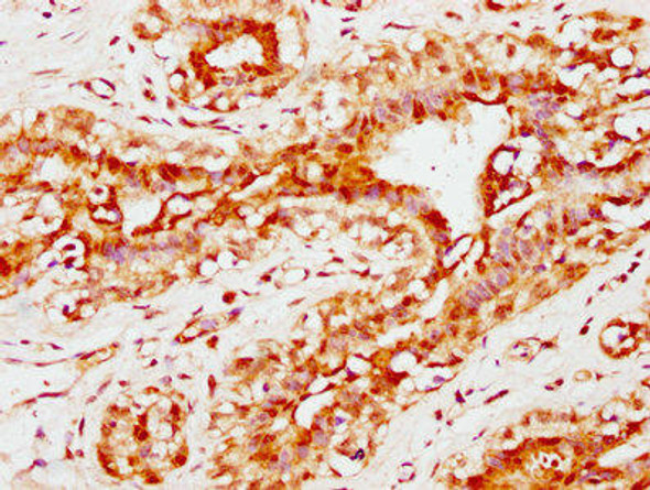 CBX4 Antibody (PACO60645)