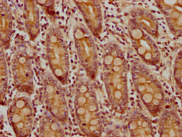 CNNM4 Antibody (PACO61037)