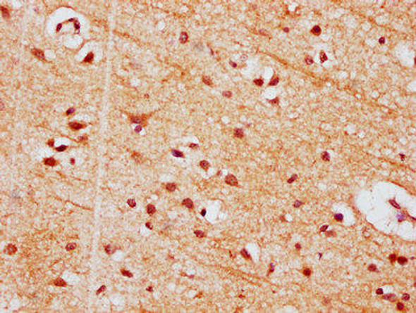 PIGT Antibody (PACO61077)