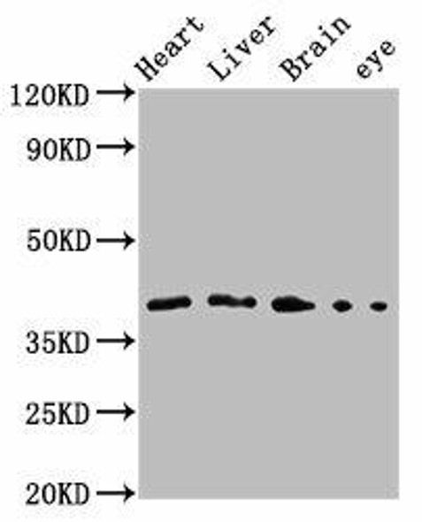 fas Antibody (PACO61754)