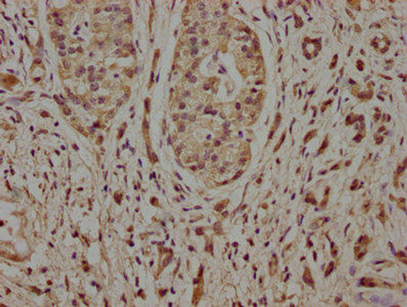 NCLN Antibody (PACO63831)