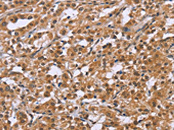 CRH Antibody (PACO17731)