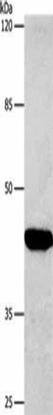 CTGF Antibody (PACO17736)