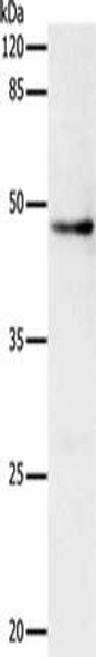 DRD1 Antibody (PACO17772)
