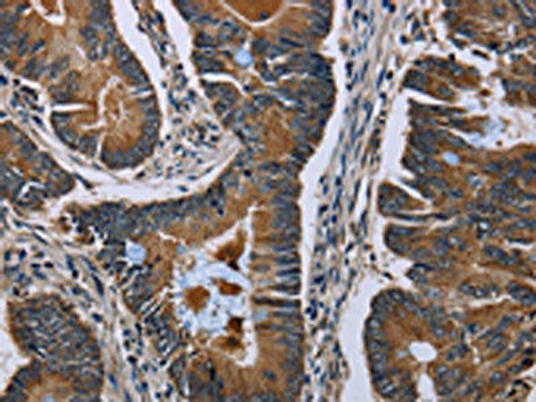 SLC1A6 Antibody (PACO17811)