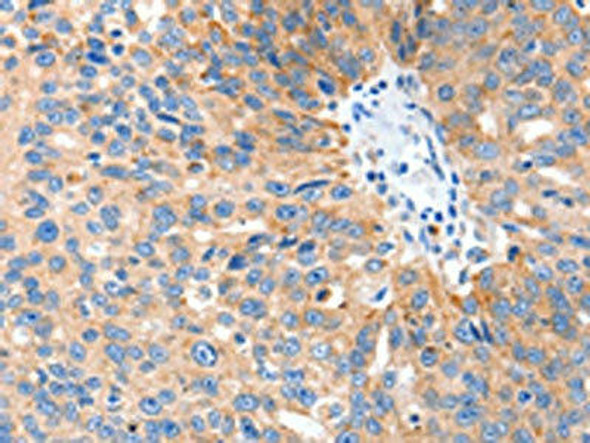 SLC2A1 Antibody (PACO17997)