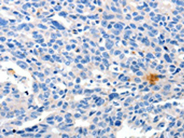 GRIN2D Antibody (PACO18308)