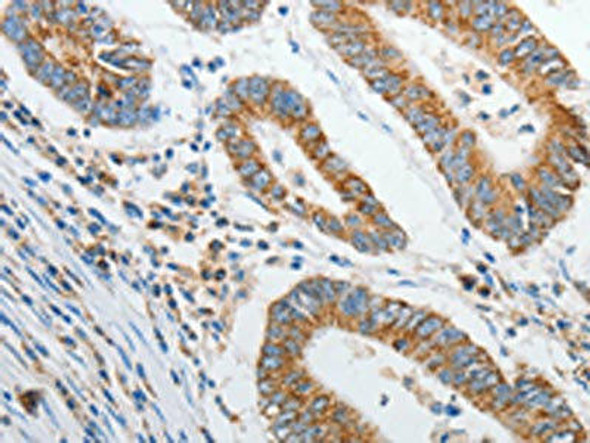 PRDX1 Antibody (PACO18366)